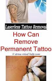 Tattoo Needles Diy Tattoo Removal Tattoo Removal Cream Buy Online India Painless Tattoo Removal How Do Tattoo Removal Cream Laser Tattoo Tattoo Removal Cost