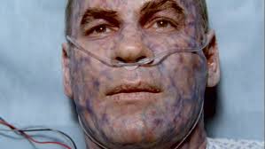 S.R. 819 6×10: At least you didn't get your ear bit off.