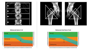 dexa scan everything you need want to know