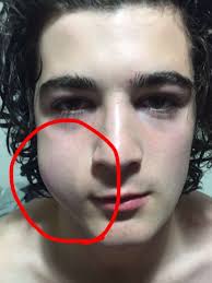 Jaw-breaking parolee first in Victoria not automatically sent back to jail  following violent offence