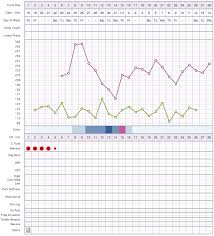 Sample Ovacue Charts Ovagraph