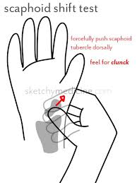 For more detail, go for this link wrist and hand examination hand examination; Hand Exam Sketchy Medicine