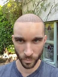 Dr. Patrick Mwamba (Fue Clinic)