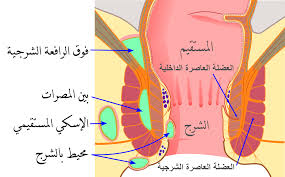 خراج شرجي مستقيمي - ويكيبيديا