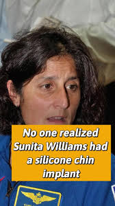 Sunni Williams Chin Before