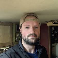 How can I fix this dent in my forehead from an accident? (Photo)