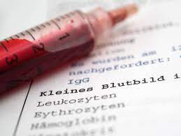 Bei harnstoff liegt der normalwert für frauen zwischen plt oder trho sind die abkürzungen für thrombozyten. Blutbild Das Steckt Hinter Den Abkurzungen Im Laborbericht Der Spiegel