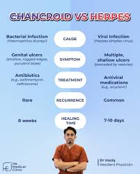 Image result for chancroid