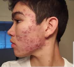 د.أسامة الطريقي (@Osamtoo)