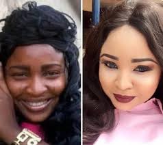 Black And White Bleaching Cream Before And After Pin On Newspost247