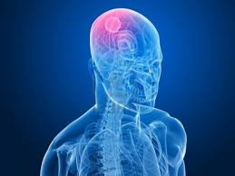 Despre clinica de recuperare medicala, kinetoterapie si fizioterapie centrokinetic. AtenÈie VÄrsÄturile SchimbÄrile De Comportament Èi Durerile De Cap La Copii Pot Fi Simptomele Tumorilor Cerebrale Ètiri BotoÈani SÄnÄtate Stiri Botosani Ro