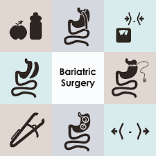 Are You Thinking About Weight Loss Surgery Here S What You Need To Know Sunshine Coast Dietetics