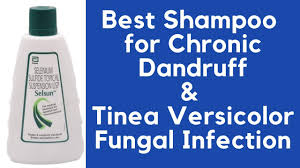 In these cases, systemic therapy may be required. Selsun I Best Medicated Shampoo For Chronic Dandruff I Also Useful For Tinea Versicolor Infection I Youtube