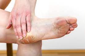 Using Vinegar Remedy For Dry Cracked Heels Mcdermott Footcare