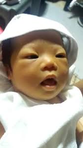 Good day mag ask lang sana if mukha po ba syang may down syndrome ? ., If  ever saan po may malapit sa taguig na may 2d echo & karyotyping . Public  lang sana .