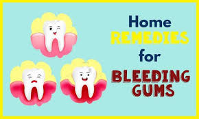 How to care for tooth extraction? Home Remedies For Bleeding Gums