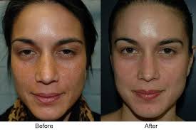This vitamin supports immune system functioning and aids collagen strength. Collagen Dr Stacey Naito S Blog