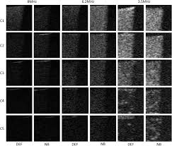 We are first introduced to him as the gray man (17.1). Acoustic Characterization And Pharmacokinetic Analyses Of New Nanobubble Ultrasound Contrast Agents Ultrasound In Medicine And Biology