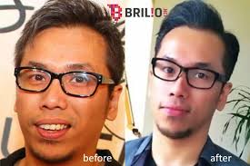 17 Foto perubahan Sammy Simorangkir, jadi ganteng dan digosipin oplas!