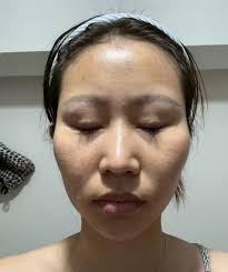 Wow! My friend Jennifer's Neo-Filler results🥹😳 No needles. No downtime.  No joke. Just a topical treatment that tells your skin to plump and fill  itself—without injections. This isn't some run-of-the-mill cream. It's