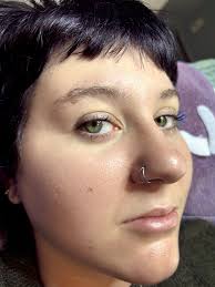 Who is a great cosmetic doctor for Botox to smooth forehead wrinkles and  lift upper eyelids?