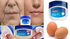 Remove Wrinkles From Face Naturally At Home Get Rid Of Deep Mouth Wrinkles Using Vaseline And Egg Youtube Mouth Wrinkles Vaseline Wrinkle Remover