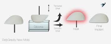 Learn about your breast enhancement and breast reconstruction options from mentor, the 20 year leader in breast implant technology. Defygravity Breast Implant Licensing Opportunity