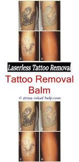 Learn how much tattoo removal typically costs, based on factors like size. How Much Laser Tattoo Removal In Philippines Laser Tattoo Removal Before And After Did Victoria Beckham Remove Tattoo Removal Laser Tattoo Tattoo Removal Cost