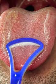 Published may 26th, 2012, 5/26/12 1:52 pm. Do You Use A Tongue Scrapper By Keeping Your Tongue Clean With The Use Of A Scraper You Will Keep Your Mouth Cleaner Dental Health Dental Health Month Dental