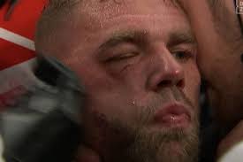 The referee stopped the bout after the eighth round because. Hglfm1tiqi4pnm