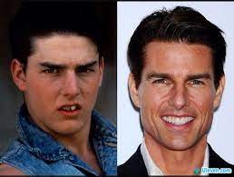 It's time for you to sit back and relax. Tom Cruise Teeth Before After Celebrity Smiles Tom Cruise Tom Cruise Teeth