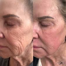 Sara Painter Katzenbach