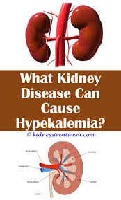 Chronic Kidney Disease Health Chronic Kidney Disease Kidney Disease Symptoms Polycystic Kidney Disease