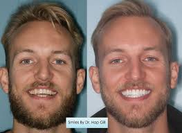 Dr Hap Gill Cosmetic Dentist