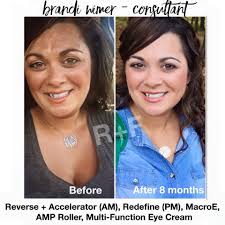 Rodan + Fields- Catherine Bost, Independent Consultant