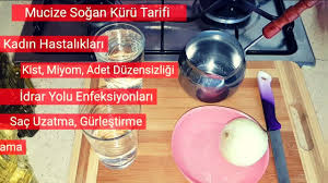 Sogan Kuru Tum Puf Noktalariyla Her Derde Deva Mutlaka Izleyin Youtube