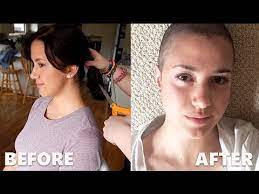 I also had same diagnosis, same first symptoms (mass in front right neck), same treatment, as in 3 rounds of rchop and 30 days of targeted radiation. Hodgkin S Lymphoma Buzzing My Hair Off Youtube