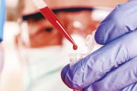 La leucemia mielógena crónica (lmc) es la más frecuente en los adolescentes. Asocian La Aparicion De Leucemia Mieloide Aguda Con La Presencia De Variaciones Geneticas En El Sistema Inmunologico