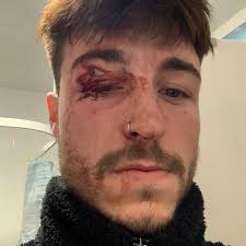 Sheffield nightclubber claims he was 'battered' by bouncers after refusing  to stop dancing