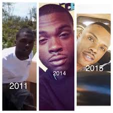 Before And After Black And White Bleaching Cream Reviews Pin On Skin Care
