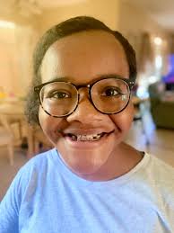 Sooooo...I've been quarantining...THANKS TO COVID-19 and I needed new  glasses. Check out my two stylish choices I ordered online. Individuals  with CCD are in constant battle with their appearance. We often feel