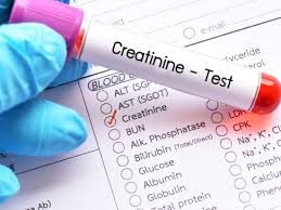 creatinine blood test purpose procedure and low or high