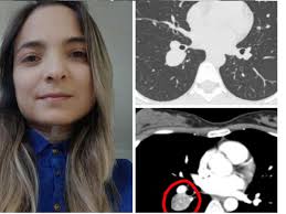 Fundraiser by CARLOS GIRON : Help Ada beat cancer for a second time