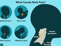 The neck pain from a sinus infection isn't isolated to the neck. Neck Pain Causes Treatment And When To See A Doctor