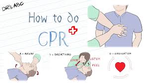 Cpr, the kiss of life, resuscitation, heart massage. How To Do Cpr Youtube
