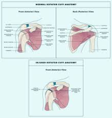 Specifically, the four rotator cuff muscles include the following Rotator Cuff Injury Lafayette Shoulder Pain Dr Vizzi