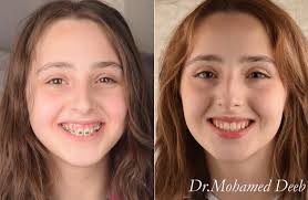 طرطوسيات Tartousiat