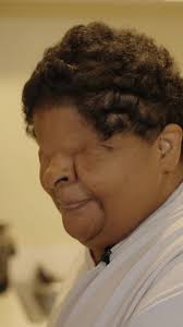 I was born without eyes