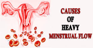 Causes Of Heavy Periods Menstrual Bleeding 247 Best Sellers Reviews Heavy Periods Heavy Period With Clots Period Bleeding