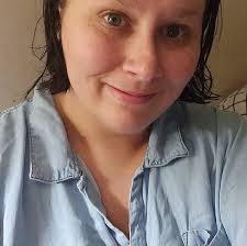 I have pulmonary and lymph nodes sarcoidosis. In the last month, I have  developed minute little bumps